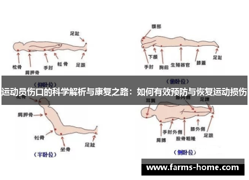 运动员伤口的科学解析与康复之路：如何有效预防与恢复运动损伤